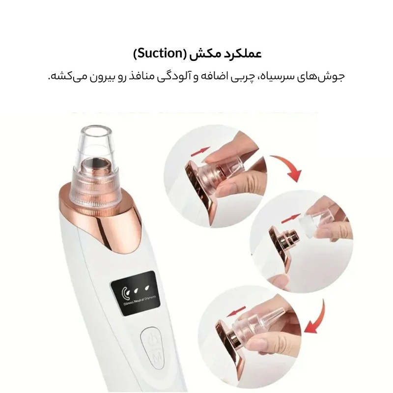 قیمت و خرید میکرودرم وینچر مدل Win